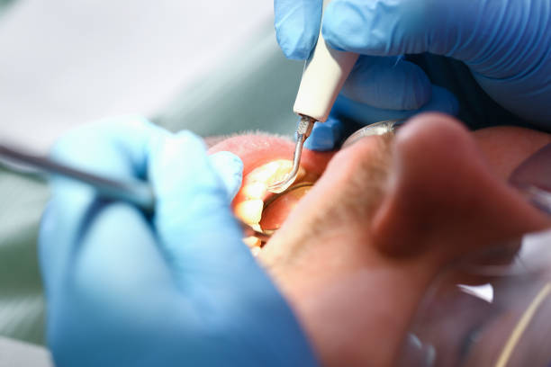Best Walk-In Emergency Dentist in Osceola, MO